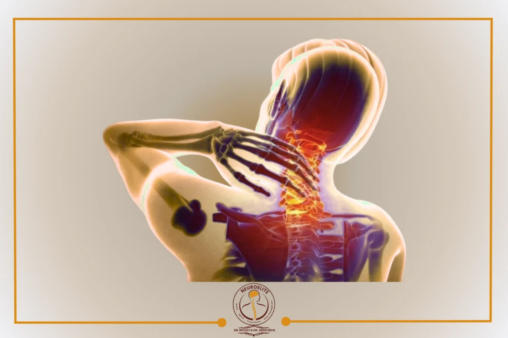 علاج للفقرة الرابعة والخامسة بدون جراحة