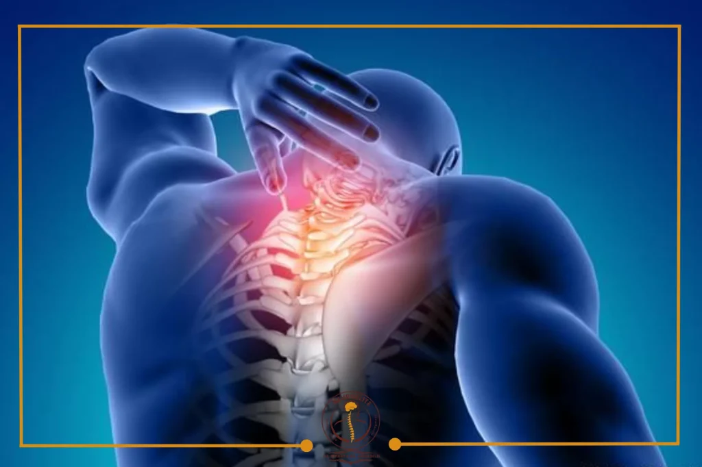 مراحل سرطان النخاع الشوكي