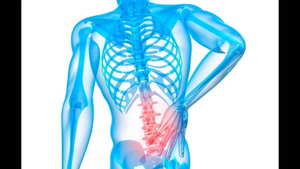 عملية تثبيت الفقرات بالبراغي